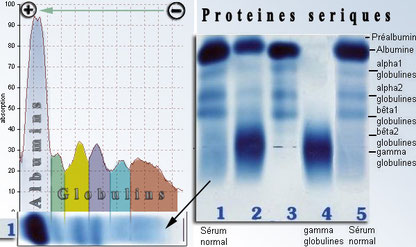 Electrophorèse des protéines sériques