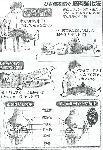 膝痛を防ぐ筋力強化法