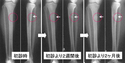 参考資料「古東整形外科」　