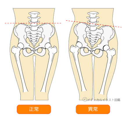 骨盤矯正ダイエット整体｜東京渋谷/横浜/船橋/名古屋/札幌
