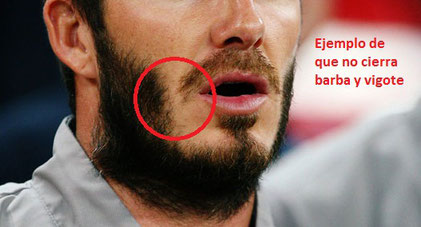 por que no funciona minoxidil barba