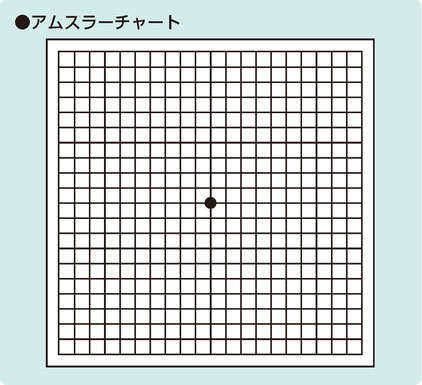 アムスラーチャート