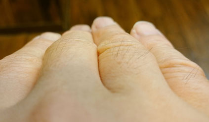  薄毛克服体験記ブログ6月24日時の店長の指の毛の写真