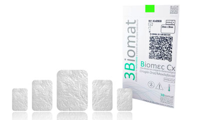 Membranas reabsorbibles