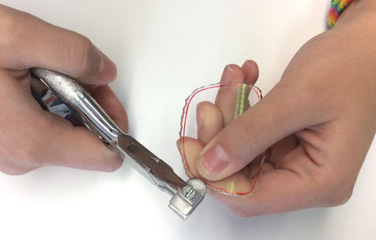 Randbearbeitung von Brillengläsern mit der Bröckelzange