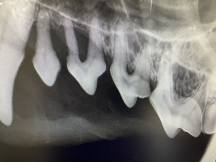 Dental-Röntgen