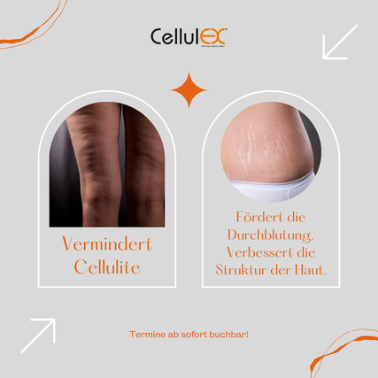 Preise Cellulex Behandlung