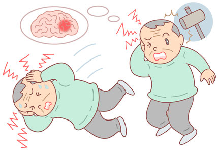 危険な頭痛
