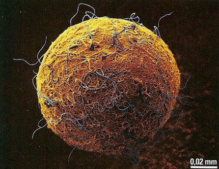 Spermatozoides (en bleu) entourant l'ovule (en jaune). La fécondation va bientôt avoir lieu.