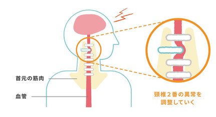 頭痛発生の原因図