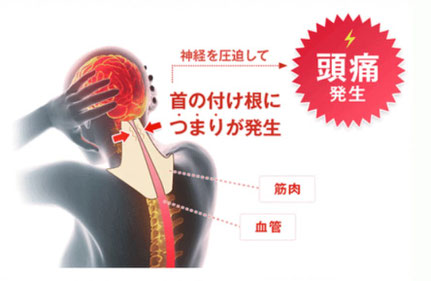 首の付け根に詰まりが発生すると、神経を圧迫して頭痛が発生します。筋肉や血管が圧迫され、血流が悪くなってしまいます。整体で頭痛が治ります。