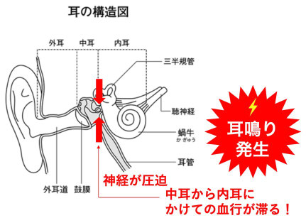耳鳴りの原因は内耳へ向かっていく神経や血管の圧迫です。