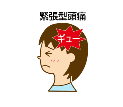ギューと締め付けられる緊張型頭痛のイラスト