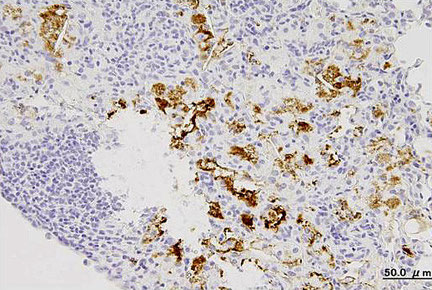 低酸素プローブ（ピモニダゾール、茶色）で染まる結核肉芽腫