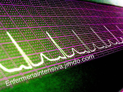 Electrocardiograma 
