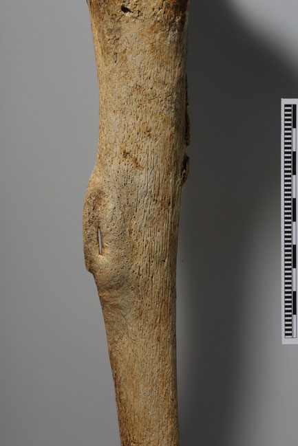 Détail sur la néo-formation osseuse sur le bord extérieur du tibia droit (Niki Gail, OEAI, the Austrian Archaeological Institute)
