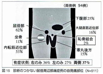 診断のつかない鼠径周辺部痛症例の自発痛部位