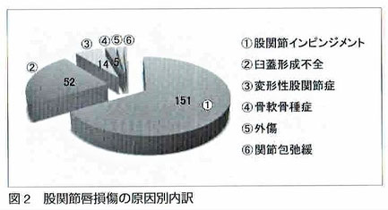 股関節唇損傷の原因別内訳