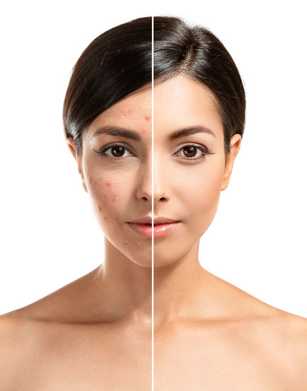 BIOPEEL X in Basel Stadt