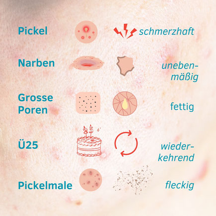 Unreine Haut Akne Pickel Pickelmale
