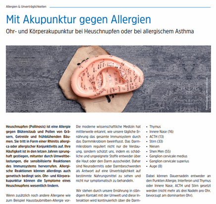 Akupunktur gegen Allergien