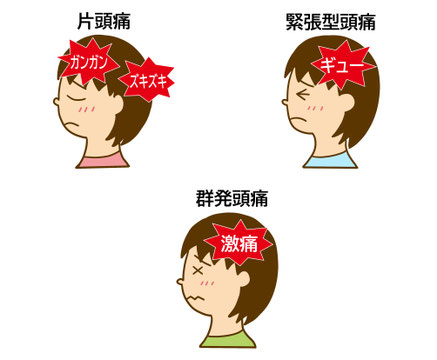 一次性頭痛の種類