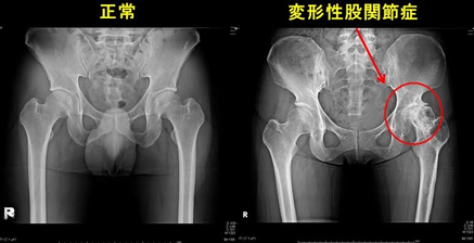 筋膜性疼痛　トリガーポイント　鍼　鍼灸　筋膜　痛み　松戸　