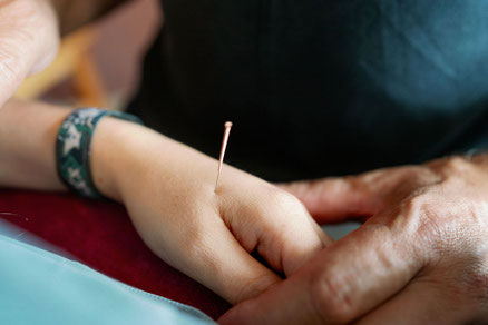 Akupunktur – Schmerzbehandlung, Allergie - praxiswohlsein-neus Webseite!