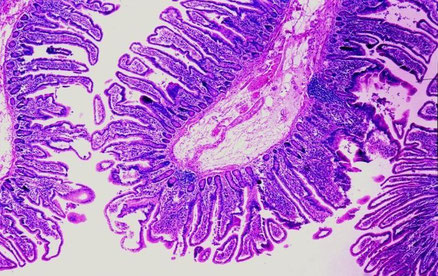 ヒトの腸内細胞:ヒトの腸内には一人当たり100種類以上、100兆個以上の嫌気性腸内細菌が生息