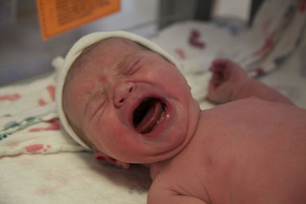 10 Signs And Symptoms Your Newborn Baby May Have A Tongue Or Lip Tie Strong Family Dentistry Spanish Fork