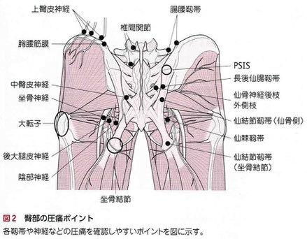 臀部の圧痛ポイント