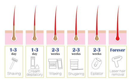 hair removal, waxing, shaving, raser, sugaring, epilator, laser, IPL