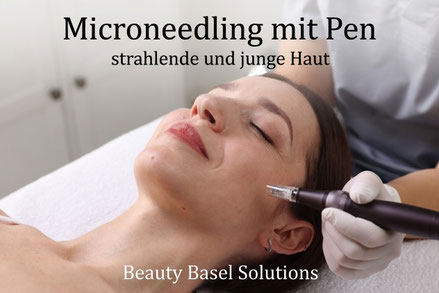 Microneedling Basel