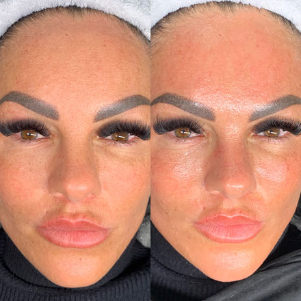 Aesthetik by Ina Zierhut - Microblading