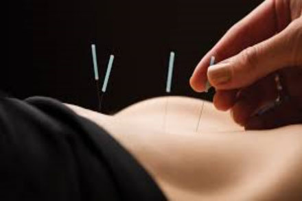 Acupunctuur/Acupuncture