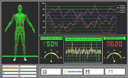 Análisis Cuántico de Resonancia Magnética