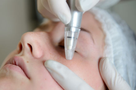 Microneedling Wolfsburg