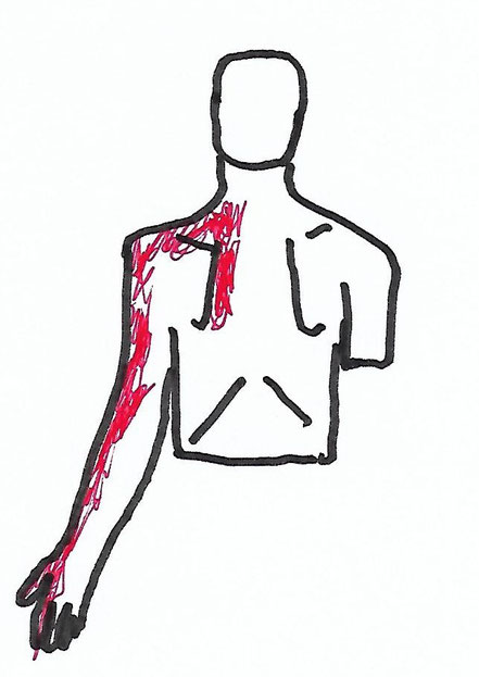 Therapie von Brust-, Arm-, und Schulterschmerzen