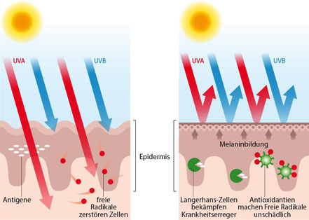 UV-Einwirkung auf die Haut