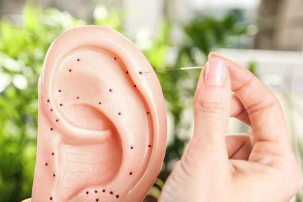 Modell der Ohr Akupunktur