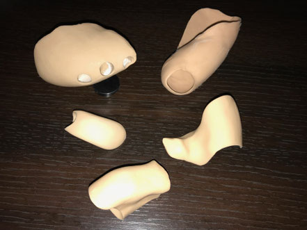 orthoplasties, hallux valgus, griffes d'orteils, protection de cors