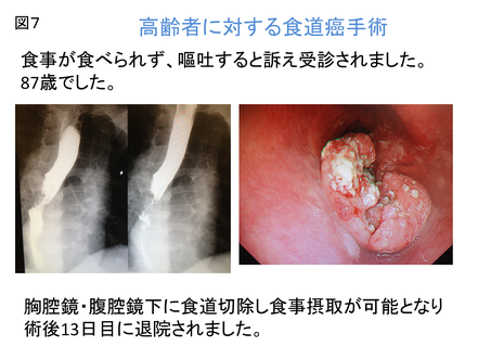 新・癌の外科手術技術シリーズ 5 食道癌　値下げ可能 新・癌の外科手術技術シリーズ 5 食道癌 値下げ可能 m3電子書籍 |