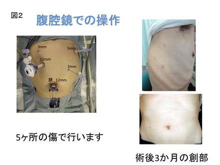 福岡での食道がんのロボット手術・胸腔鏡手術はこちらへ - 福岡 福岡での食道がんのロボット手術・胸腔鏡手術はこちらへ - 福岡