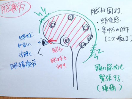 脳疲労を改善する方法 Yurumu整体院 堺市なかもずのちょっと変わった整体院