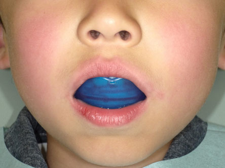 向ケ丘遊園駅北口徒歩3分、登戸駅徒歩10分、多摩区役所そばのカワシマ歯科医院 マウスピピース プレオルソ