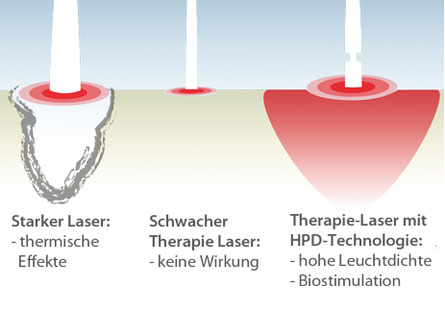 Grafik Laser-Akupunktur