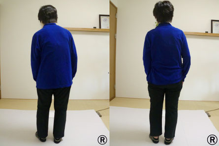 しんそう福井武生では症状は姿勢に現れると考えて、体の姿勢を改善していきます