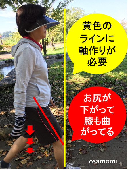 歩き方の改善は昭島市のオサモミ整体院。骨盤後傾!
