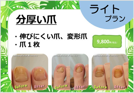足裏ケア＋爪ケアのセット料金　１２０分　12,800円