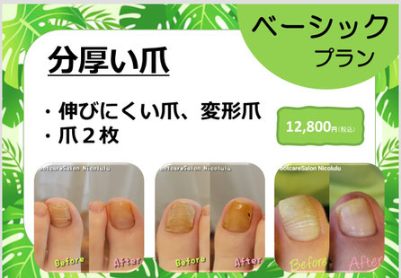 足裏ケア＋爪ケアのセット料金　１５０分　15,800円